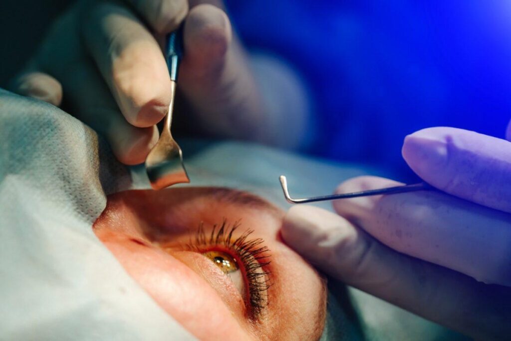 Cirugia-de-ojo