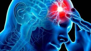accidente-cerebrovascular-acv