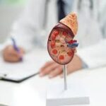 Hospitales del interior evaluarán pacientes para trasplante renal